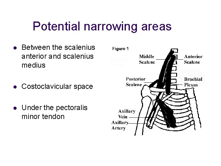 Potential narrowing areas l Between the scalenius anterior and scalenius medius l Costoclavicular space