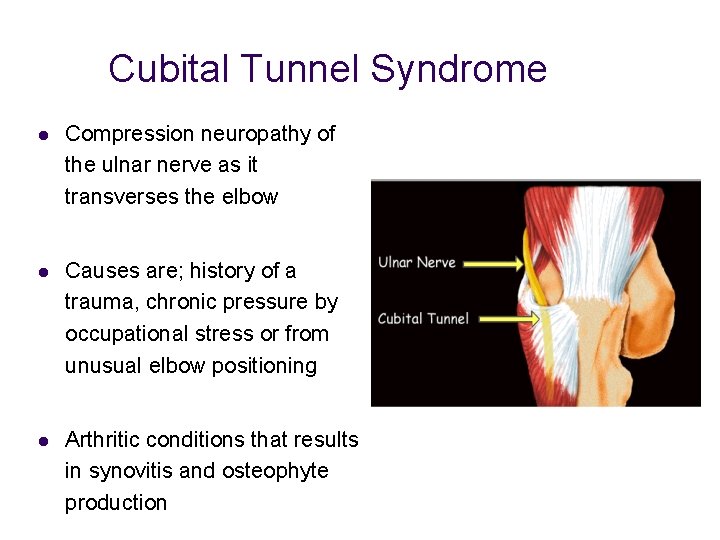 Cubital Tunnel Syndrome l Compression neuropathy of the ulnar nerve as it transverses the