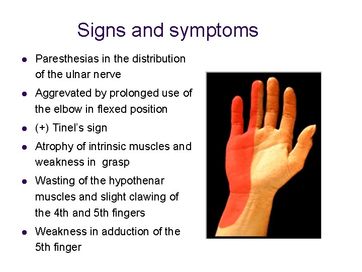 Signs and symptoms l Paresthesias in the distribution of the ulnar nerve l Aggrevated