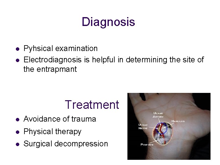 Diagnosis l l Pyhsical examination Electrodiagnosis is helpful in determining the site of the