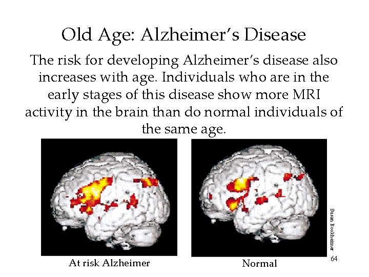 Old Age: Alzheimer’s Disease The risk for developing Alzheimer’s disease also increases with age. Old Age: Alzheimer’s Disease The risk for developing Alzheimer’s disease also increases with age.