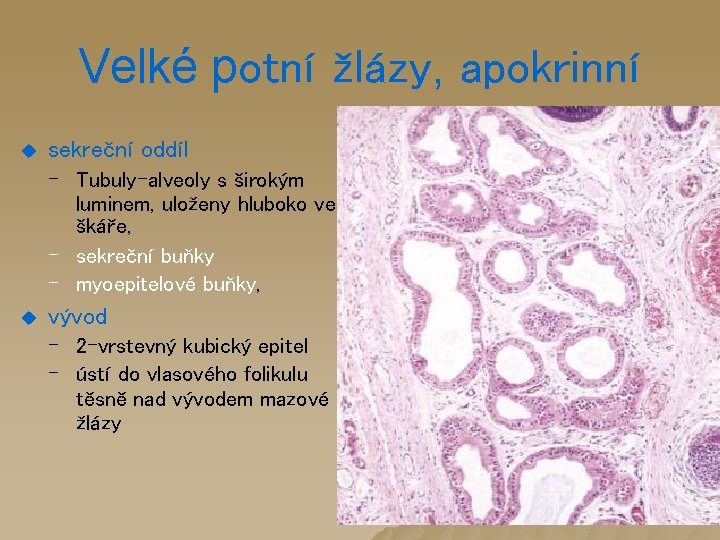 Velké potní žlázy, apokrinní u sekreční oddíl – Tubuly-alveoly s širokým luminem, uloženy hluboko