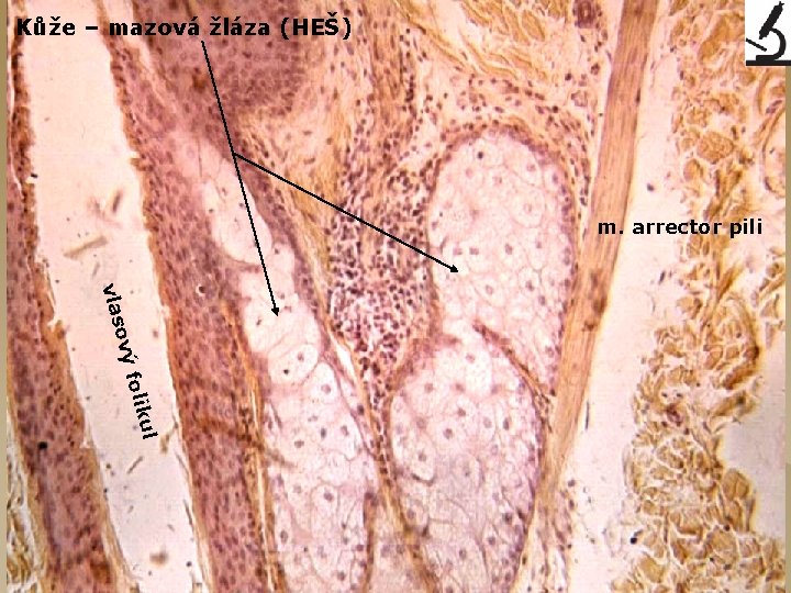 Kůže – mazová žláza (HEŠ) m. arrector pili ul folik ový vlas 