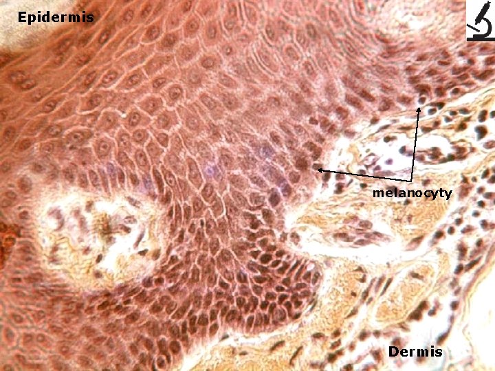 Epidermis melanocyty Dermis 