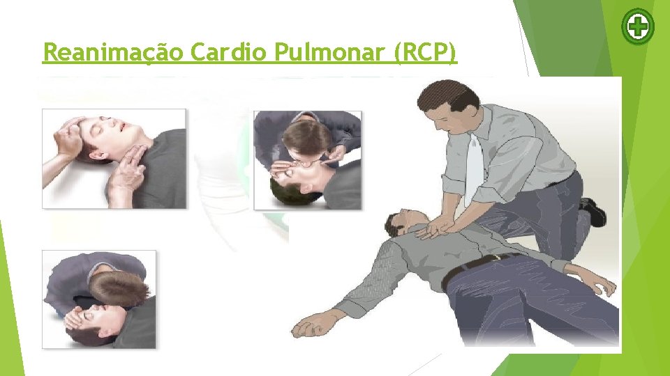 Reanimação Cardio Pulmonar (RCP) 