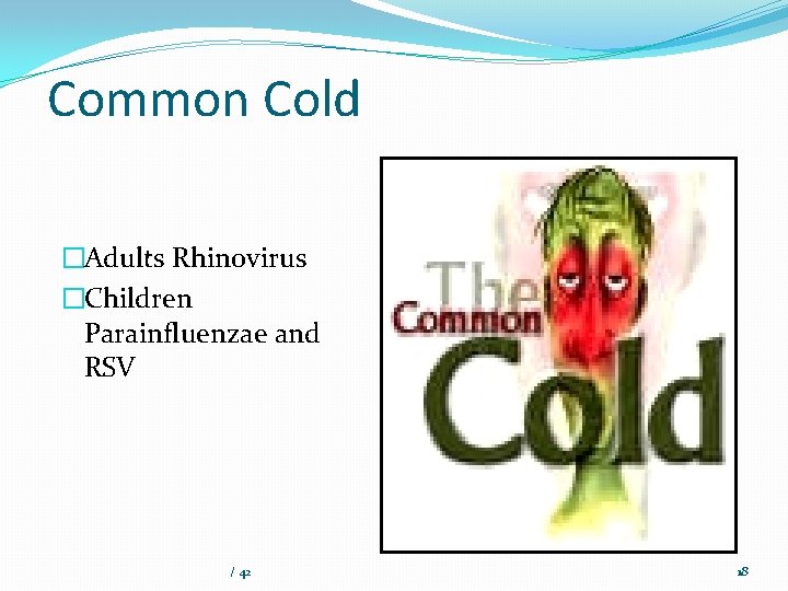 Common Cold �Adults Rhinovirus �Children Parainfluenzae and RSV / 42 18 