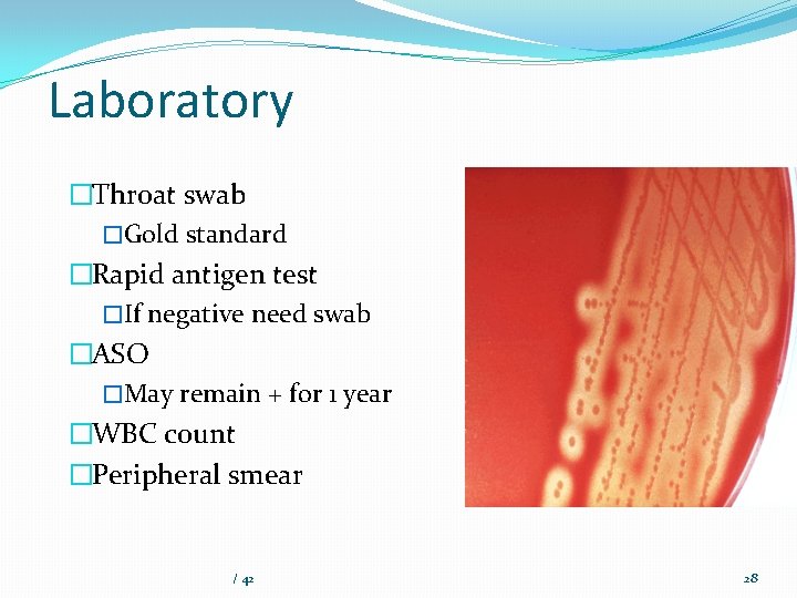 Laboratory �Throat swab �Gold standard �Rapid antigen test �If negative need swab �ASO �May