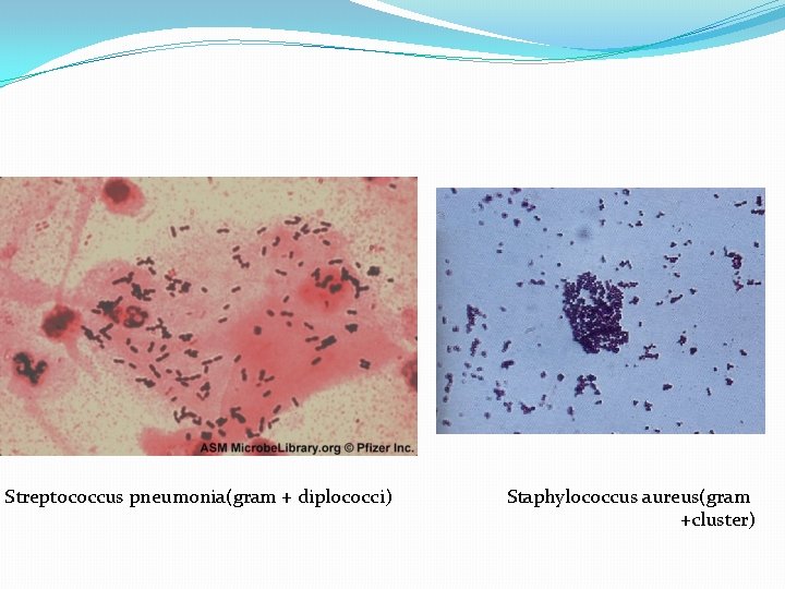 Streptococcus pneumonia(gram + diplococci) Staphylococcus aureus(gram +cluster) 