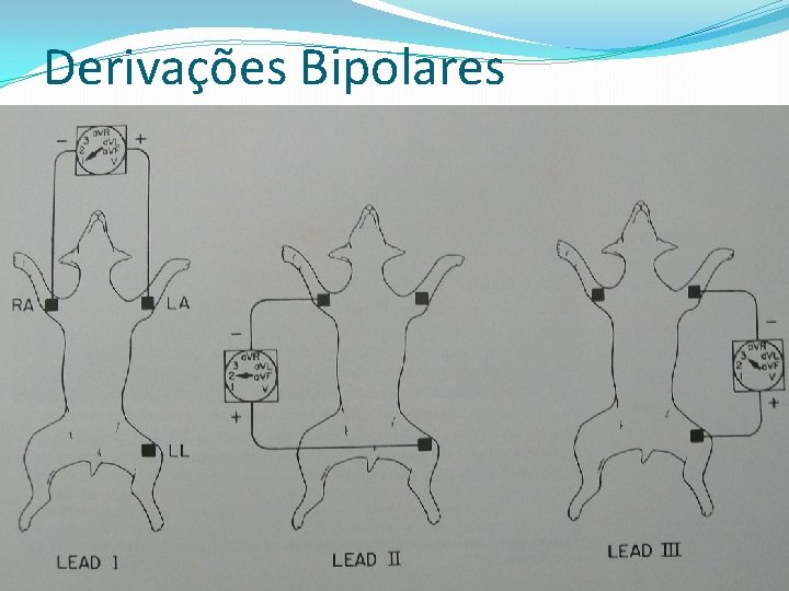 Derivações Bipolares DI DIII 