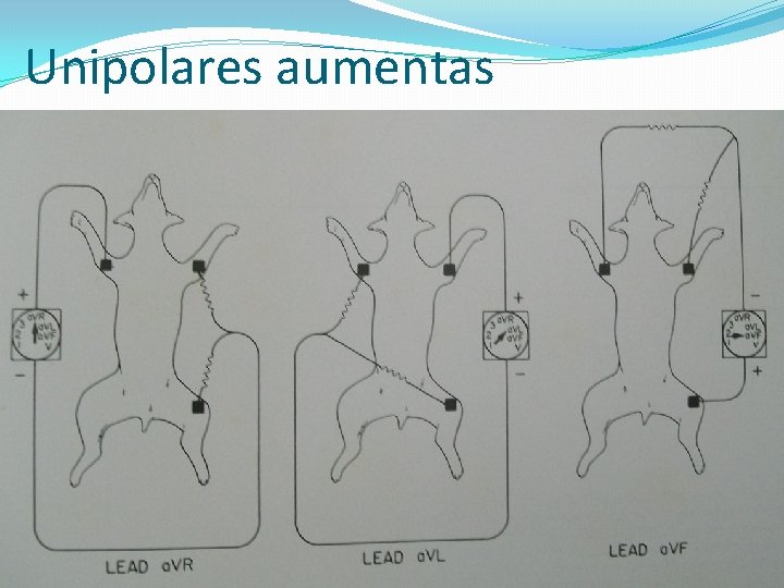Unipolares aumentas 
