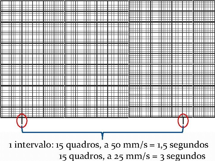 1 intervalo: 15 quadros, a 50 mm/s = 1, 5 segundos 15 quadros, a