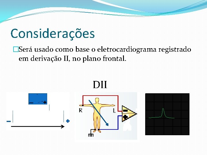 Considerações �Será usado como base o eletrocardiograma registrado em derivação II, no plano frontal.