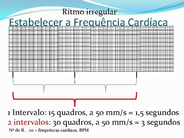 Ritmo irregular Estabelecer a Frequência Cardíaca 1 Intervalo: 15 quadros, a 50 mm/s =