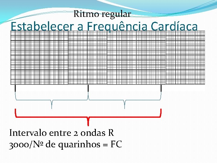 Ritmo regular Estabelecer a Frequência Cardíaca Intervalo entre 2 ondas R 3000/Nº de quarinhos