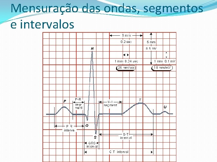 Mensuração das ondas, segmentos e intervalos 