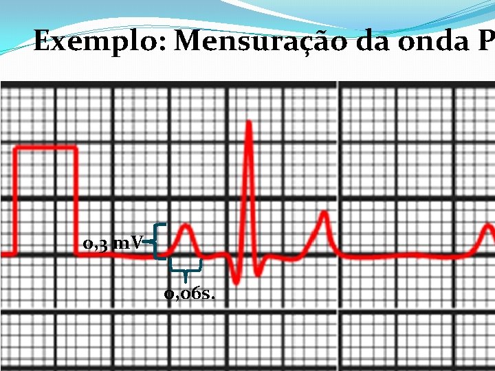 Exemplo: Mensuração da onda P 0, 3 m. V 0, 06 s. 