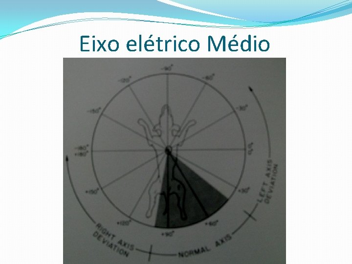 Eixo elétrico Médio 