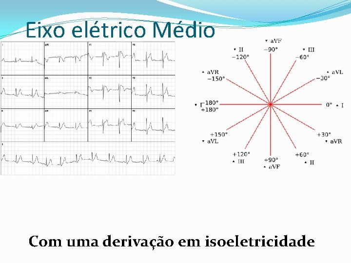 Eixo elétrico Médio Com uma derivação em isoeletricidade 