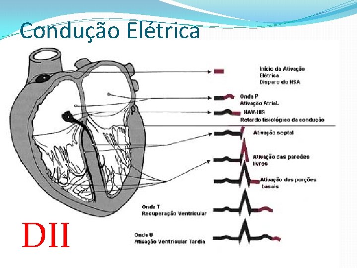 Condução Elétrica DII 