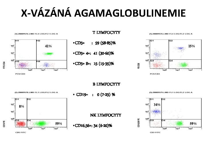 X-VÁZÁNÁ AGAMAGLOBULINEMIE T LYMFOCYTY • CD 3+ 41% : 59 (58 -85)% 15% •