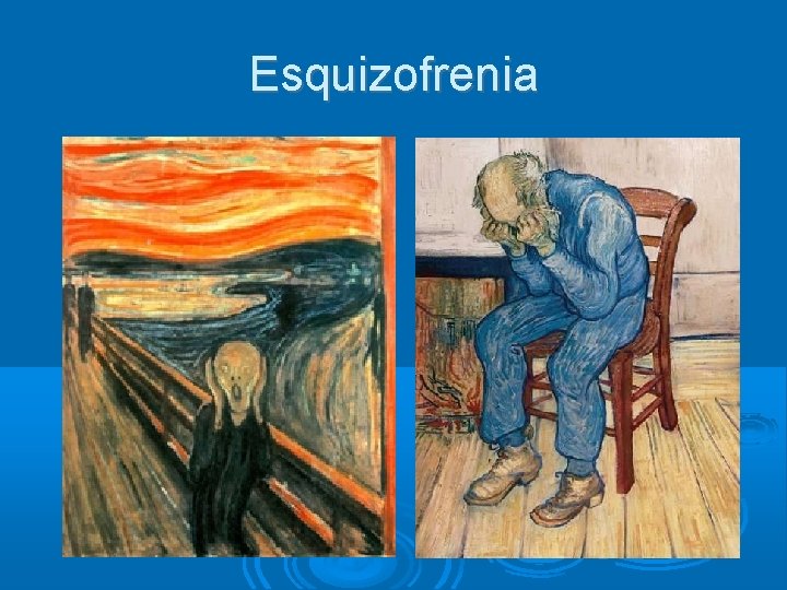 Esquizofrenia 