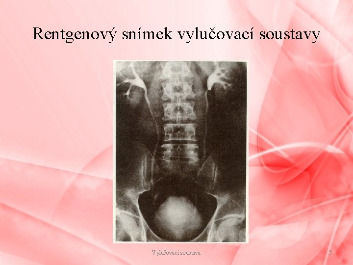 Rentgenový snímek vylučovací soustavy Vylučovací soustava 5 