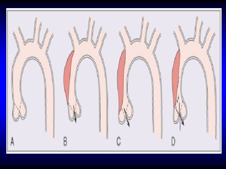 Fig 53 -14 