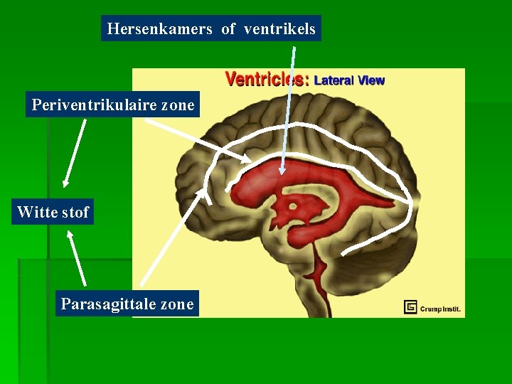 Hersenkamers of ventrikels Periventrikulaire zone Witte stof Parasagittale zone 