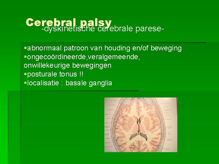Cerebral palsy -dyskinetische cerebrale parese§abnormaal patroon van houding en/of beweging §ongecoördineerde, veralgemeende, onwillekeurige bewegingen