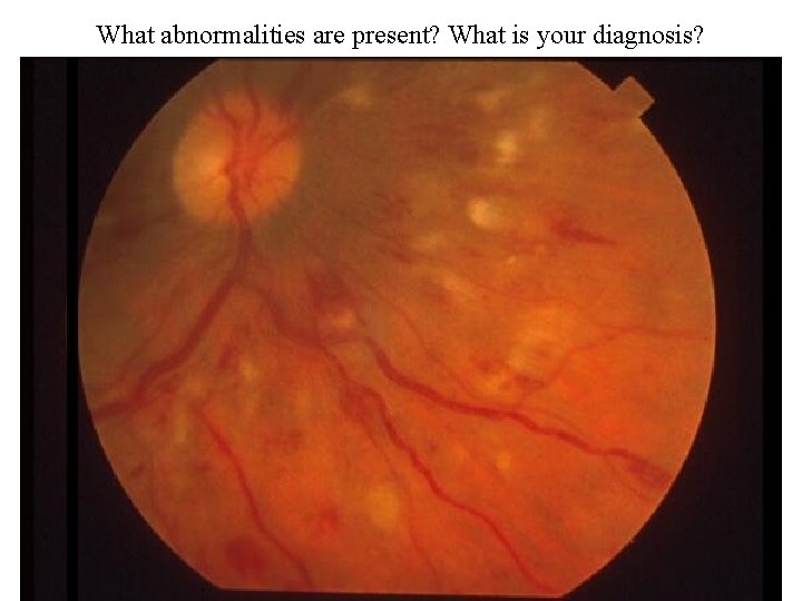 What abnormalities are present? What is your diagnosis? 