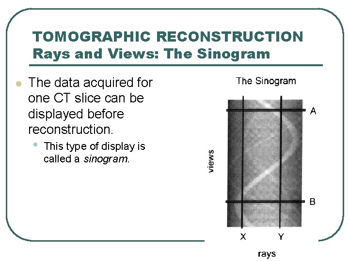 TOMOGRAPHIC RECONSTRUCTION Rays and Views: The Sinogram l The data acquired for one CT