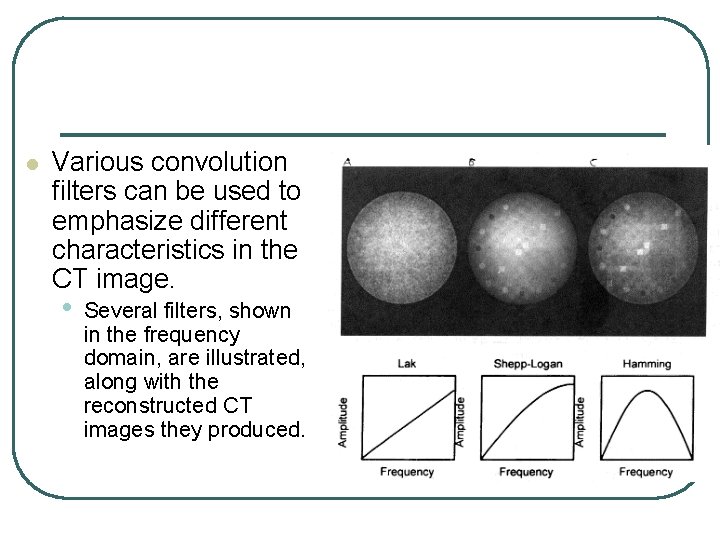 l Various convolution filters can be used to emphasize different characteristics in the CT