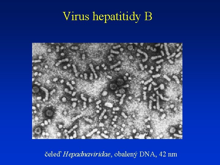 Virus hepatitidy B čeleď Hepadnaviridae, obalený DNA, 42 nm 