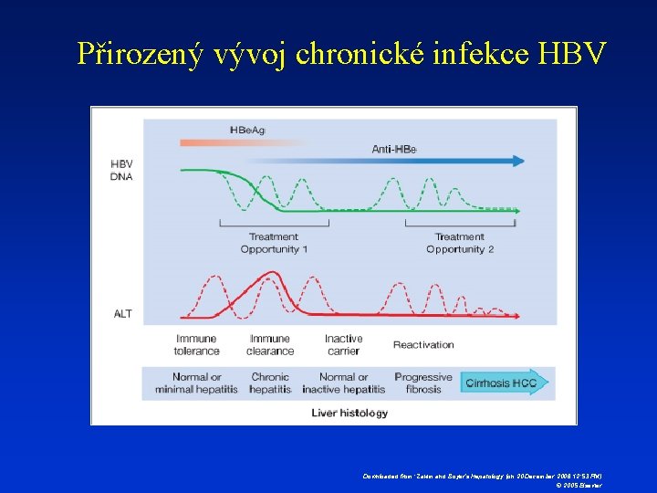 Přirozený vývoj chronické infekce HBV Downloaded from: Zakim and Boyer’s Hepatology (on 20 December