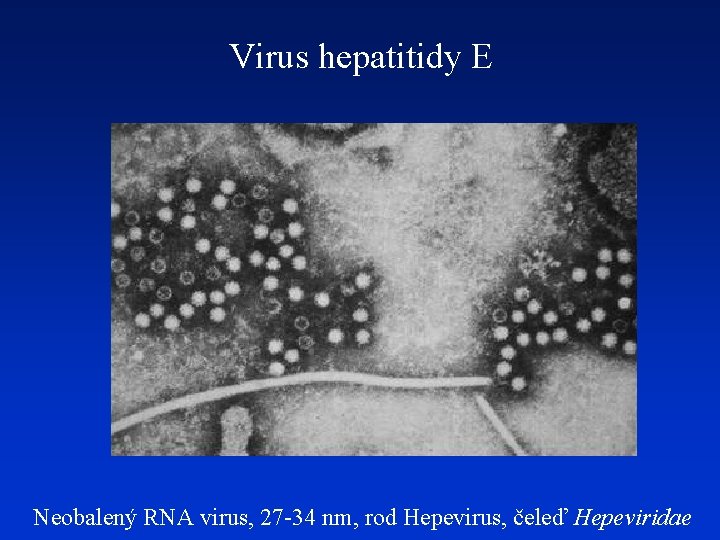 Virus hepatitidy E Neobalený RNA virus, 27 -34 nm, rod Hepevirus, čeleď Hepeviridae 