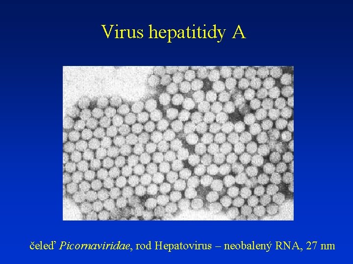Virus hepatitidy A čeleď Picornaviridae, rod Hepatovirus – neobalený RNA, 27 nm 