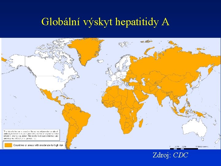 Globální výskyt hepatitidy A Zdroj: CDC 