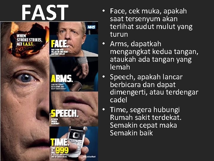 FAST • Face, cek muka, apakah saat tersenyum akan terlihat sudut mulut yang turun