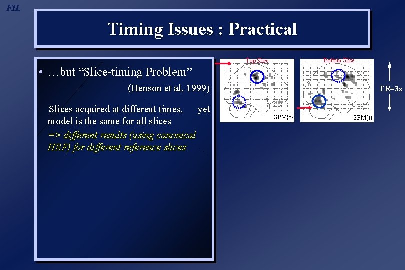 FIL Timing Issues : Practical Bottom Slice Top Slice • …but “Slice-timing Problem” (Henson