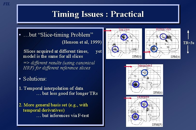 FIL Timing Issues : Practical Bottom Slice Top Slice • …but “Slice-timing Problem” (Henson