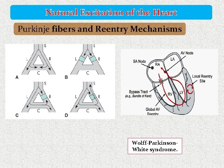 Natural Excitation of the Heart Purkinje fibers and Reentry Mechanisms Wolff-Parkinson. White syndrome. 