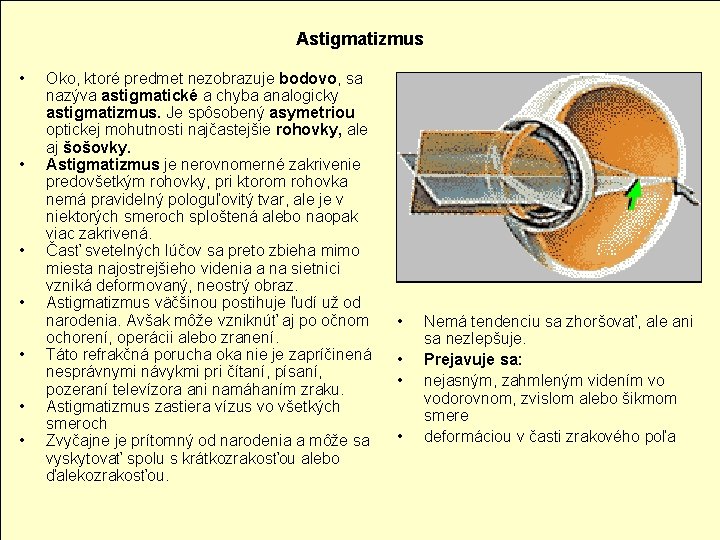Astigmatizmus • • Oko, ktoré predmet nezobrazuje bodovo, sa nazýva astigmatické a chyba analogicky