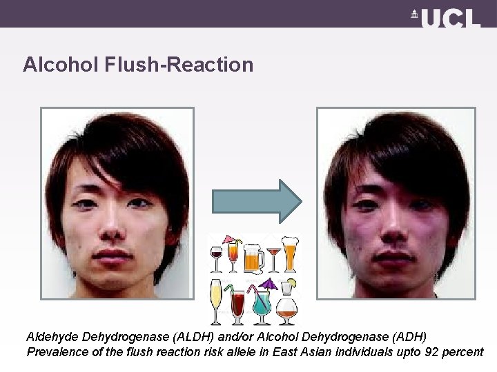 Alcohol Flush-Reaction Aldehyde Dehydrogenase (ALDH) and/or Alcohol Dehydrogenase (ADH) Prevalence of the flush reaction