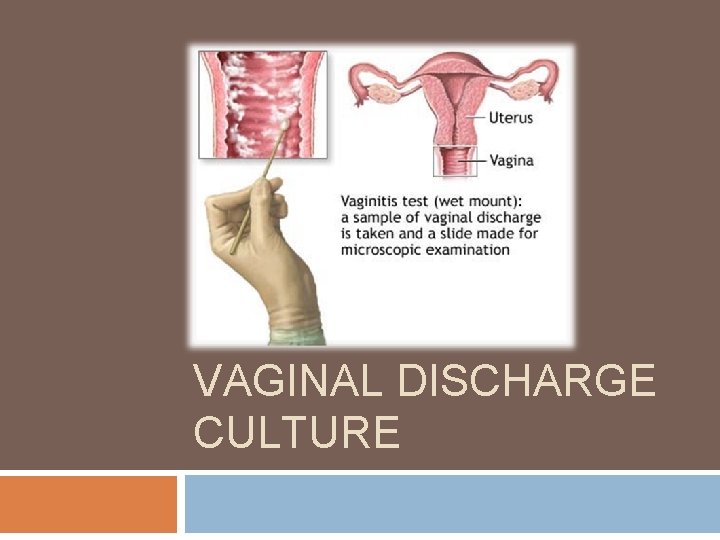 VAGINAL DISCHARGE CULTURE 