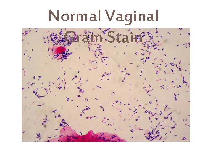 Normal Vaginal Gram Stain.