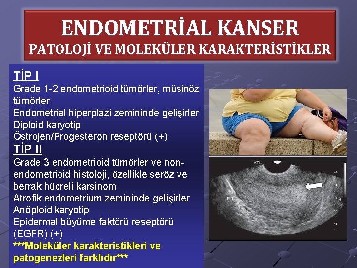 ENDOMETRİAL KANSER PATOLOJİ VE MOLEKÜLER KARAKTERİSTİKLER TİP I Grade 1 -2 endometrioid tümörler, müsinöz