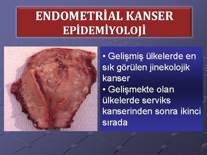 ENDOMETRİAL KANSER EPİDEMİYOLOJİ • Gelişmiş ülkelerde en sık görülen jinekolojik kanser • Gelişmekte olan