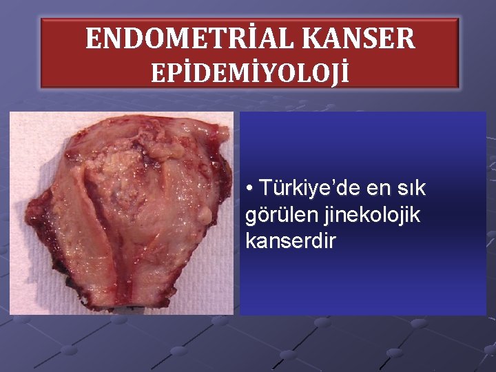 ENDOMETRİAL KANSER EPİDEMİYOLOJİ • Türkiye’de en sık görülen jinekolojik kanserdir 