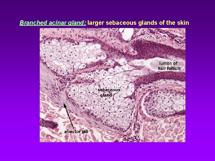 Branched acinar gland: larger sebaceous glands of the skin 