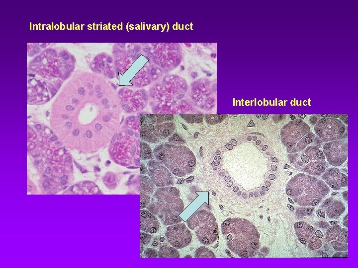 Intralobular striated (salivary) duct Interlobular duct Intralobular striated (salivary) duct Interlobular duct
